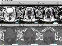 Image of the prostate